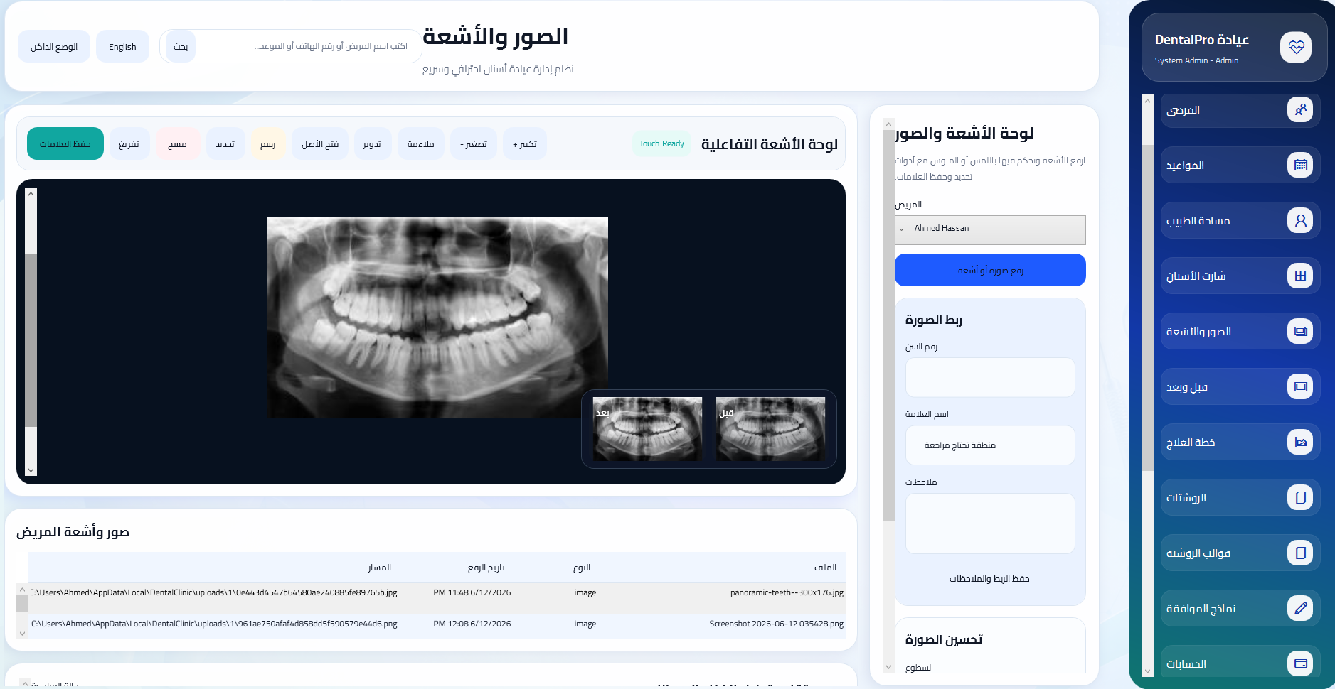 مكتبة الأشعة والصور داخل DentalPro